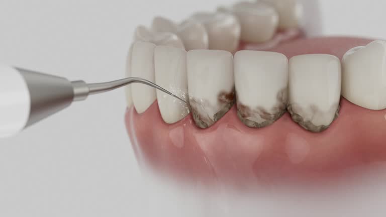 Reliable Dental Implants contractor in Summit Park, UT by Smile Center Dentistry